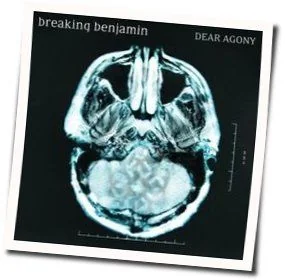 Forget It Chords by Benjamin Breaking